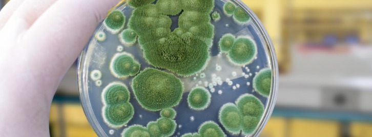 SanTuPur | Pathogen Technology Survey